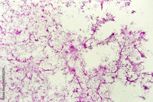 Actinomycetes under the microscope