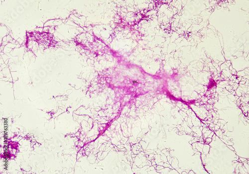 Actinomycetes under the microscope