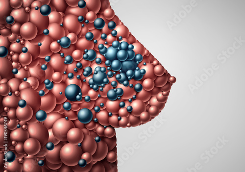 Metastatic Breast Cancer