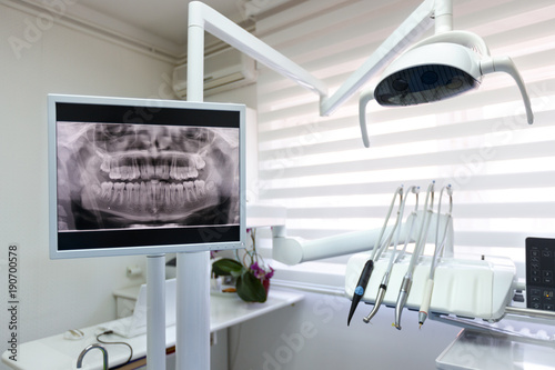 Dental x-ray footage in dental clinic