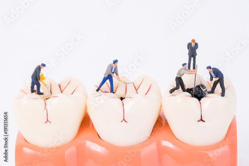 miniature people and dental model,dental care concept