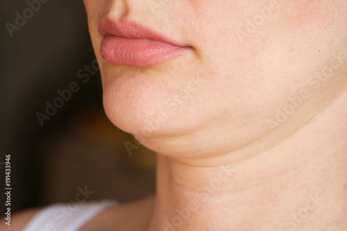 face line correction. a woman with a second chin