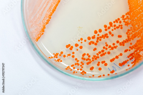 Serratia marcescens is a species of rod-shaped gram-negative bacteria in the family Enterobacteriaceae for Laboratory microbiology.