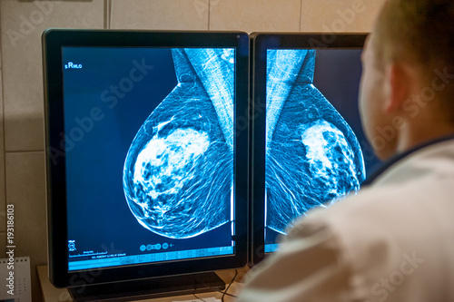 Doctor examines mammogram snapshot of breast of female patient on the monitors. Selective focus.