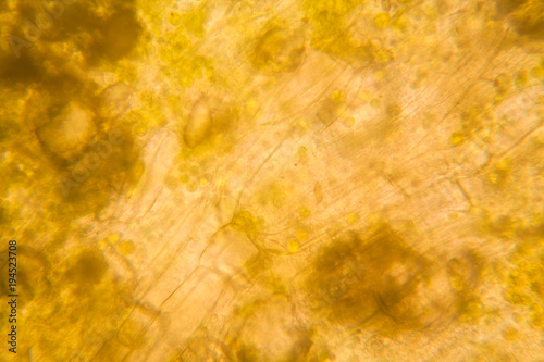 Rotten leaves at the microscope 