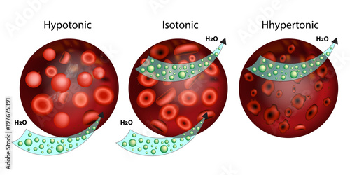  Effect of different solutions on blood cells.The effect of osmosis on cells. Hypotonic, Isotonic, and Hypertonic solution. Tonicity