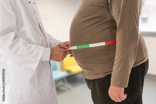 Doctor measuring obese man waist body fat. Obesity and weight loss.