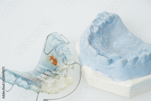 Dental retainer orthodontic appliance on the white background.