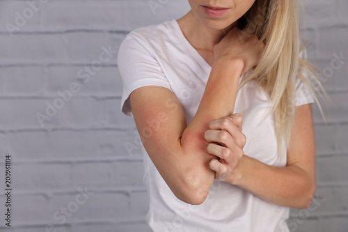 Woman Scratching an itch . Sensitive Skin, Food allergy symptoms, Irritation