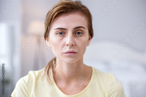 Hair loss. Tuft if hair being in hands of a depressed ill woman