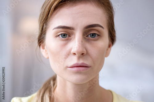 Sad look. Cheerless sad woman looking at you while suffering from a serious illness