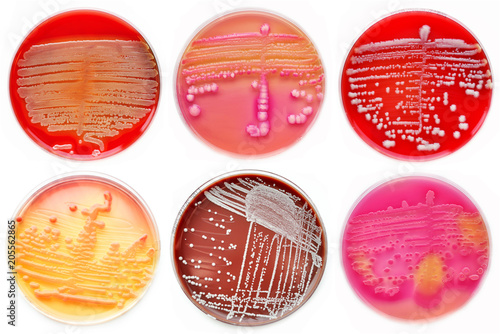 Mixed of bacteria colonies in petri dish, blood agar, chocolate agar, MacConkey agar