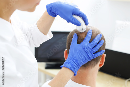 Trycholog. Wypadanie włosów. Mężczyzna u lekarza. Głowa mężczyzny z przerzedzonymi włosami podczas badania skóry głowy i włosów mikroskopem