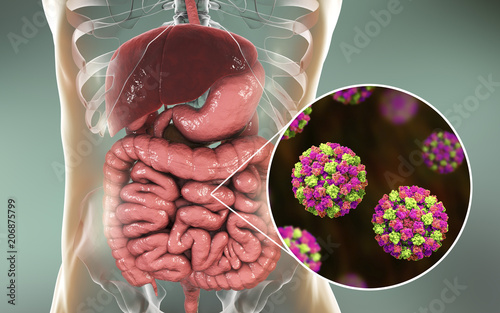 Norovirus in human intestine, also called winter vomiting bug, RNA virus from Caliciviridae family, causative agent of gastroenteritis with diarrhea, vomiting, stomach pain. 3D illustration