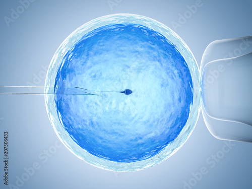 artificial insemination or ivf