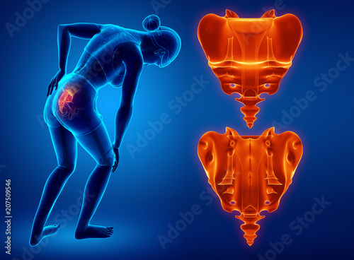 3d illustration of sacrum bone pain