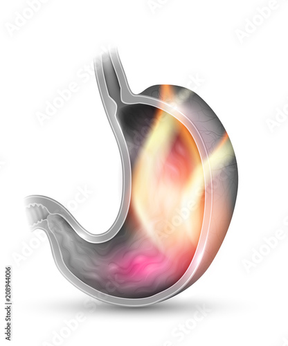 Stomach disorder abstract design on a white background