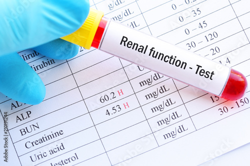 Abnormal high renal function test results with blood sample tube