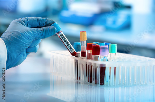 Technician holding blood tube test in the research laboratory / doctor hand taking a blood sample tube from a rack with machines of analysis in the lab background 