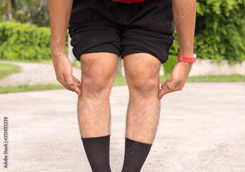 Asian man leg bandy-legged shape of the legs