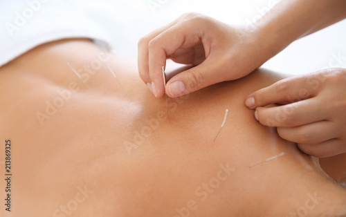 Young woman undergoing acupuncture treatment in salon, closeup