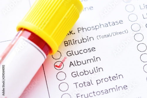 Blood sample tube with laboratory requisition form for albumin protein test