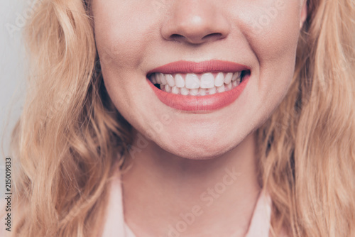 Crop close up portrait half face of woman with blond hair and shiny beaming smile while being at the dentist