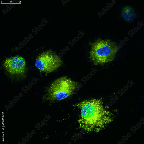 Confocal microscopy of mesenchymal stem cell