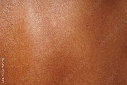 close-up human skin damged by age and sun tanning