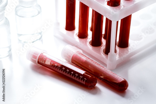 glass tubes with blood sample in stand no one