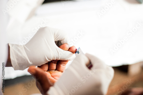 above view of bleeding finger after puncture for free hiv test in african hospital