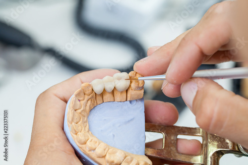 dental technician works by brush with jaw model