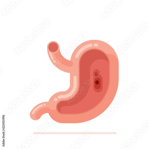 Stomach ulcer concept flat design