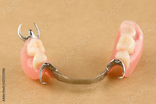 arc dental prosthesis