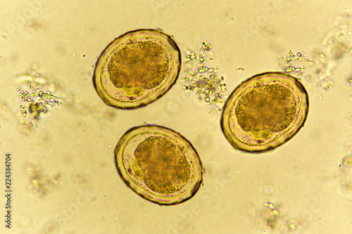 Eggs of Ascaris lumbricoides (roundworm) in stool, analyze by microscope 