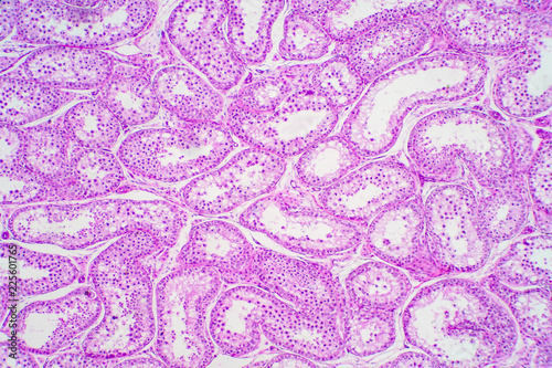 Cross section Human testis under microscope view.