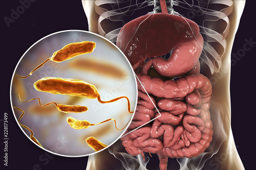 Vibrio cholerae bacteria in small intestine, 3D illustration. Bacterium which causes cholera disease and is transmitted by contaminated water