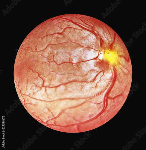 3d illustration of Optical Coherence Tomography OCT