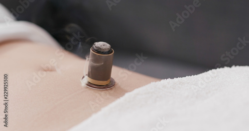 Chinese traditional medicine moxibustion therapy