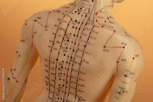 Back from Acupuncture Model