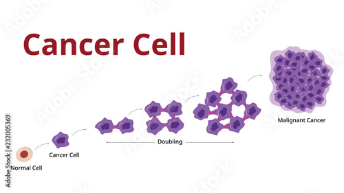 Cencer cell stage, Process, Development , vector