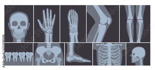 Vector illustration of realistic set of many X-rays pictures of human body. Transparent X-ray photos on white background.