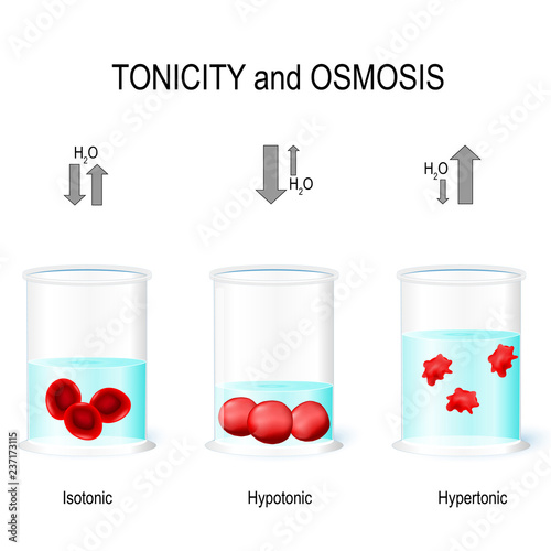 Isotonic, Hypotonic and Hypertonic solutions effects on animal cells.