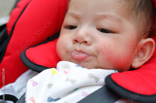 cute baby boy happy playful bubbles saliva drool on child mouth with allergic rash on kid chubby cheeks