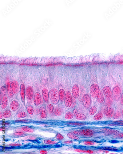 Ciliated pseudostratified columnar epithelium