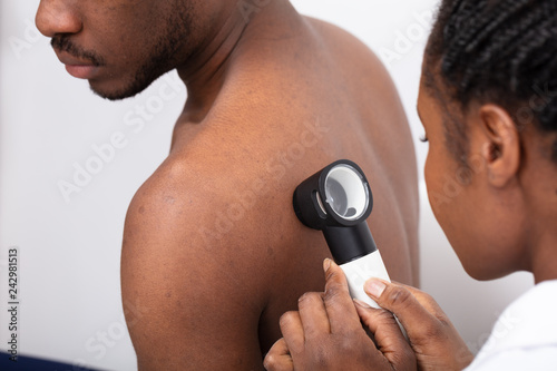 Close-up Of A Doctor Checking Pigment Skin On Man's Back