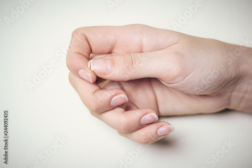 Close-up of brittle nails. A broken nail on your finger.