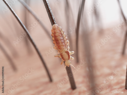 3d rendered illustration of a head louse