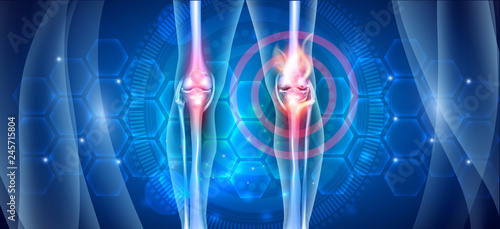 Joint knee problems diagram on an abstract blue scientific background with abstract fire, joint ache concept