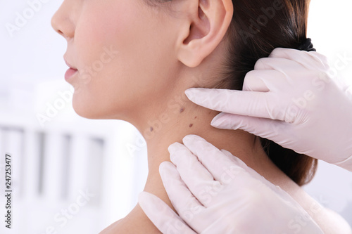 Dermatologist examining patient in clinic, closeup view